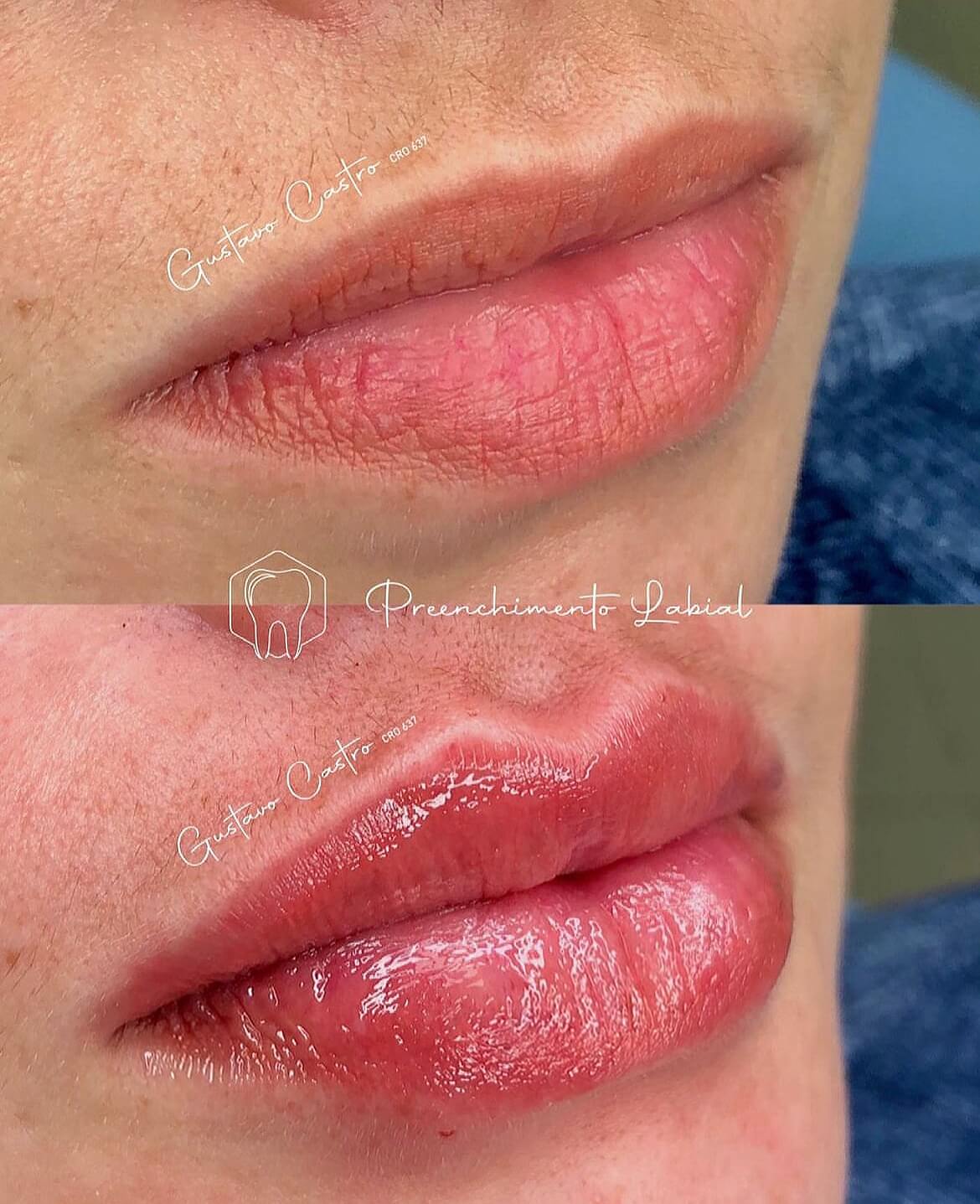 AirBrush_20230615075230