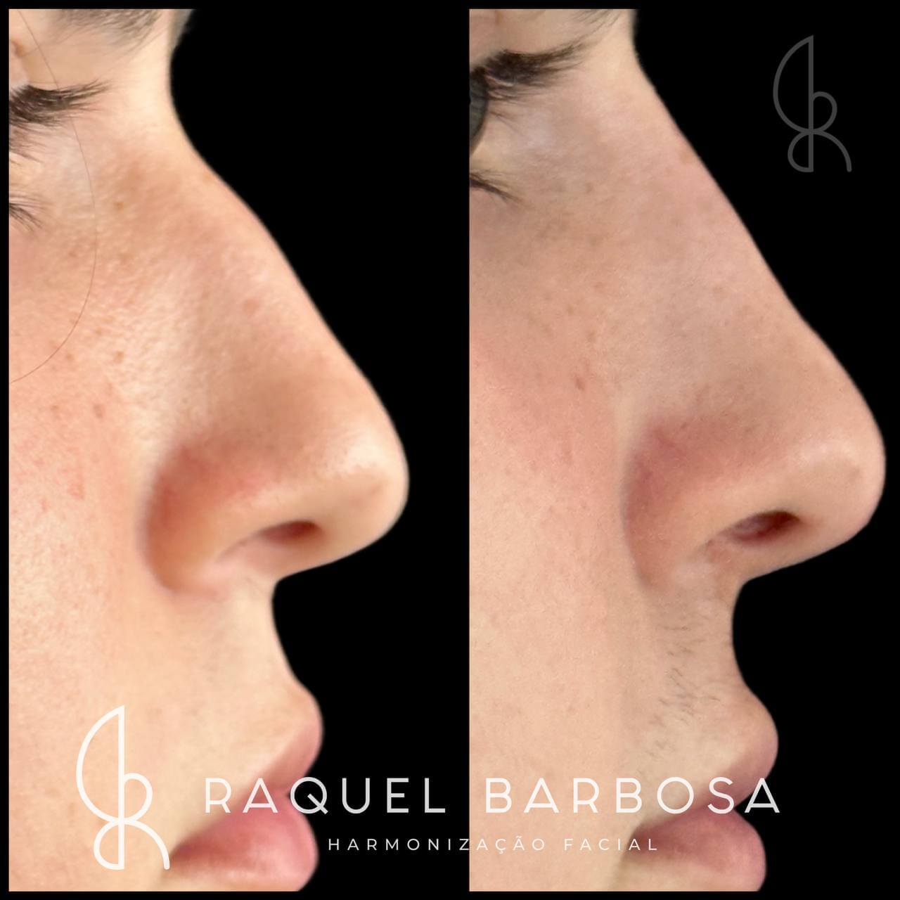 IMG_20230513_115820_814